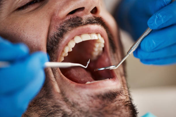 Professional Emergency Dentist in MO