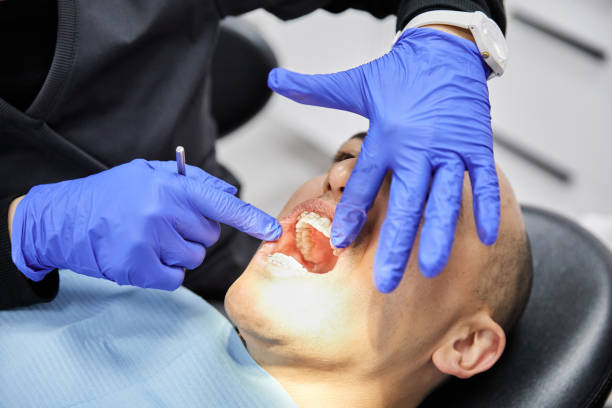 Best Cracked Tooth Emergency Dentist  in Clayco, MO