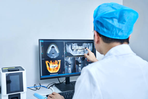 Emergency Dental Filling Replacement in MO